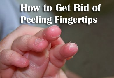 How to Get Rid of Peeling Fingertips