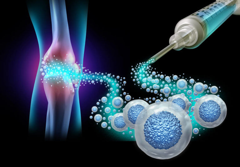 The Role of Stem Cell Therapy in Regenerative Medicine